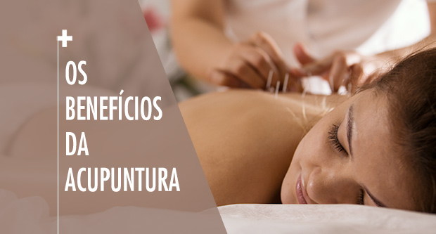Os beneficios da acupuntura